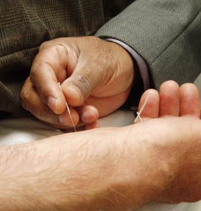 Hand inserting a thin acupuncture needle into another person's arm.