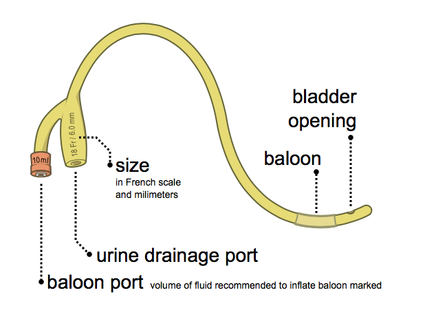 A diagram of a yellow indwelling (Foley) catheter labelling the drainage port, size, balloon port, and bladder opening