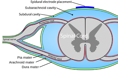 Epidural Stimulation - SCIRE Community