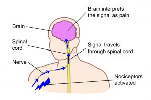 Image of a person's body from the shoulder up showing a nerve from the arm to the spinal cord, the spinal cord in the centre of the body connecting to the brain. A blue arrow on the skin is captioned 'nociceptors activated'. Blue arrows move up the nerve towards the spinal cord and up the spinal cord to the brain, captioned 'signal travels through spinal cord'. The arrows reach the brain captioned 'brain interprets the signal as pain'.