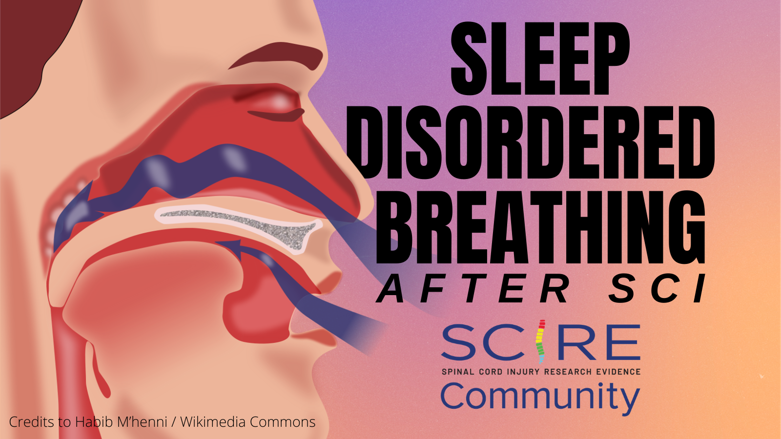 Background: purple, orange, and pink Left half: cartoon image of a person's side profile with the anatomy person's nasal cavity with air flowing in Text: Sleep Disordered Breathing After SCI SCIRE Community logo: Spinal Cord Injury Research Evidence