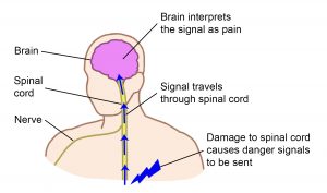 Image of a person's body from the shoulder up showing a nerve from the arm to the spinal cord, the spinal cord in the centre of the body connecting to the brain. A blue lightning bolt points at the spinal cord captioned 'damage to spinal cord causes danger signals to be sent'. Blue arrows move up the spinal cord to the brain, captioned 'signal travels through spinal cord'. The arrows reach the brain captioned 'brain interprets the signal as pain'.