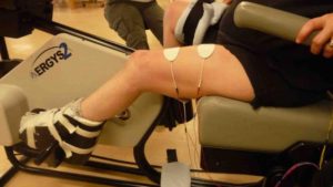 A leg with two electrodes on the thigh for functional electrical stimulation execise therapy